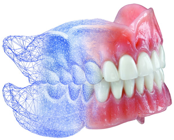 Prothèses dentaires numériques, Prothèses digitales